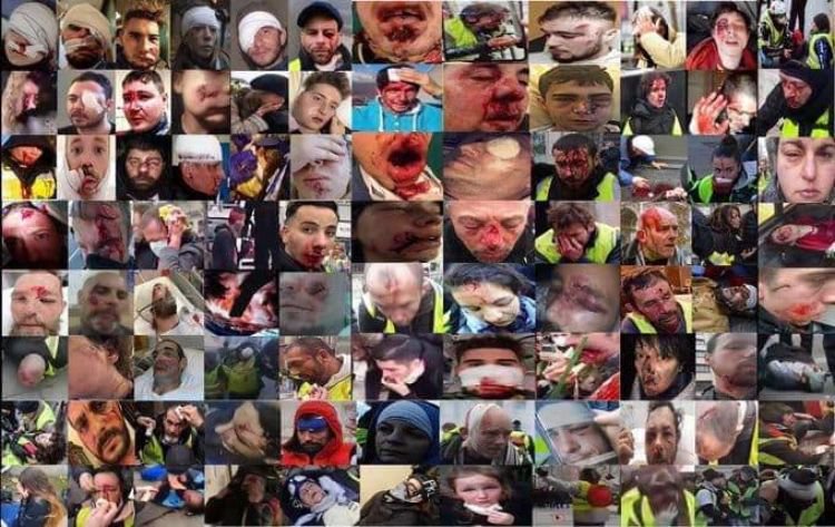 blessés lors des manifestations gilets jaunes