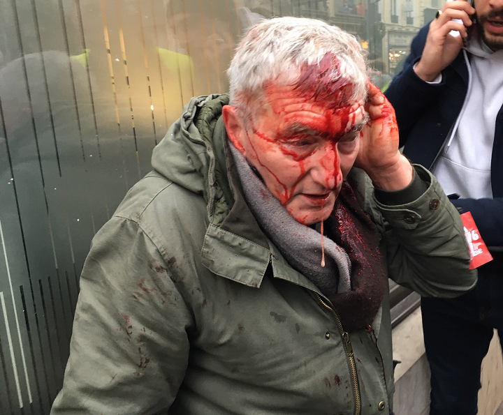 police grève violence gaz